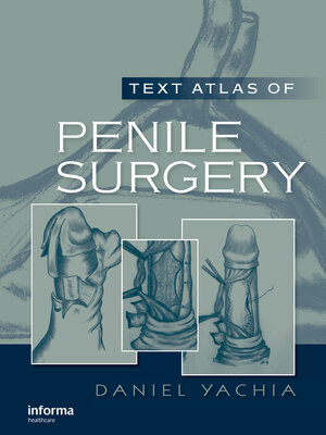 cover image of Text Atlas of Penile Surgery